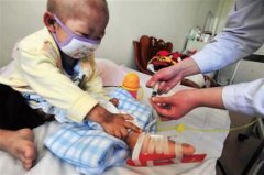 “白血病”兒童增加，甲醛危害值得關(guān)注